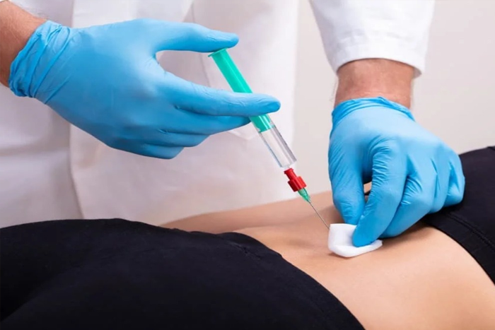 عوارض اوزون تراپی دیسک کمر