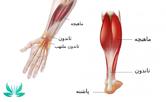 تاندون چیست