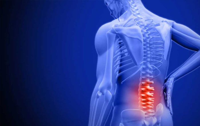 علت دیسک کمر چیست؟