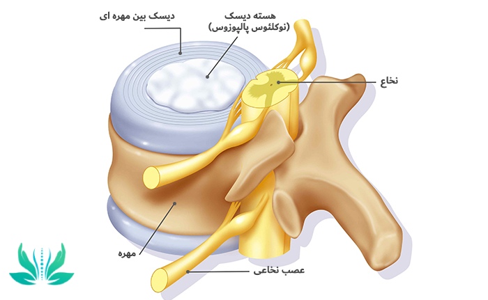 دیسک گردن کجاست؟