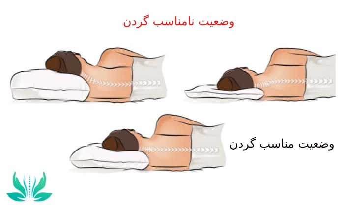 مراقبت‌های ضروری برای افراد مبتلا به دیسک گردن