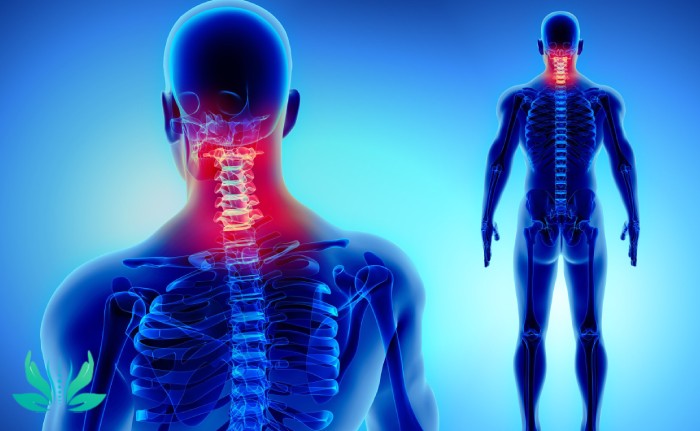دلایل ابتلا به رادیکولوپاتی