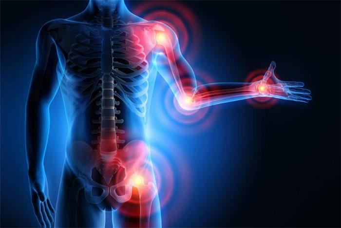  عوامل مؤثر در بروز سرطان استخوان