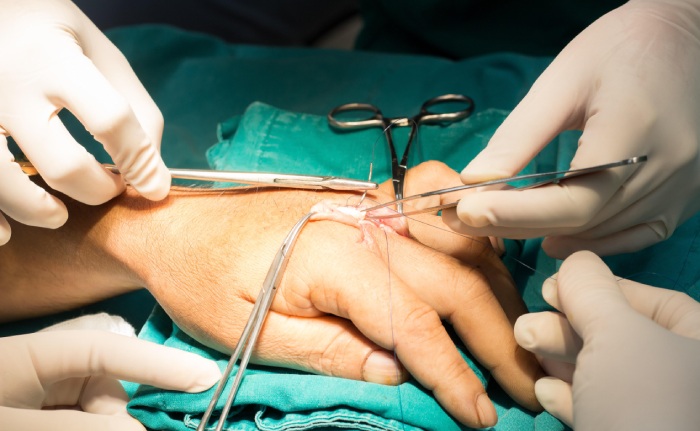 عمل عصب دست چگونه انجام می‌شود؟