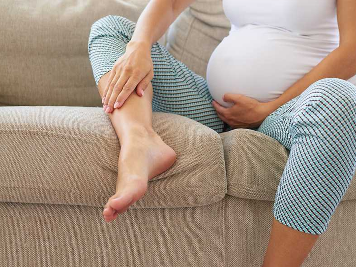ورزش برای واریس در بارداری
