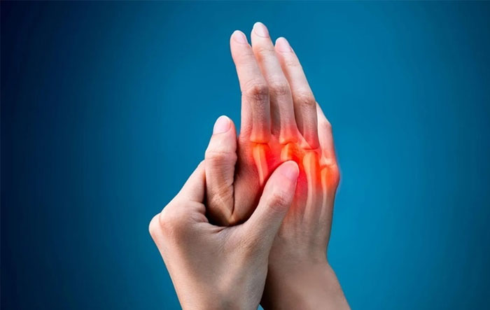پیشگیری از آرتروز در جوانی 