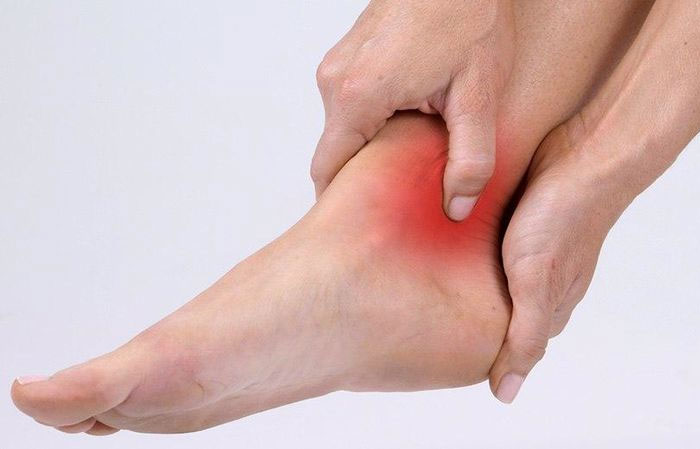 چه پمادی برای پیچ خوردگی مچ پا خوب است؟
