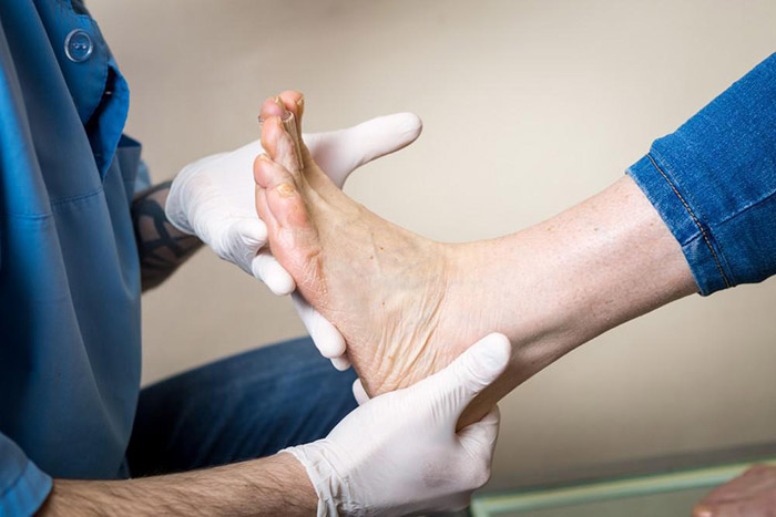  درمان بیماری های مچ پا با روش های غیر جراحی