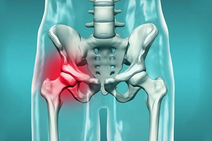 علت درد استخوان لگن و باسن