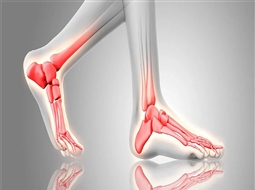 شکستگی استرسی چیست و چگونه ایجاد می‌شود؟