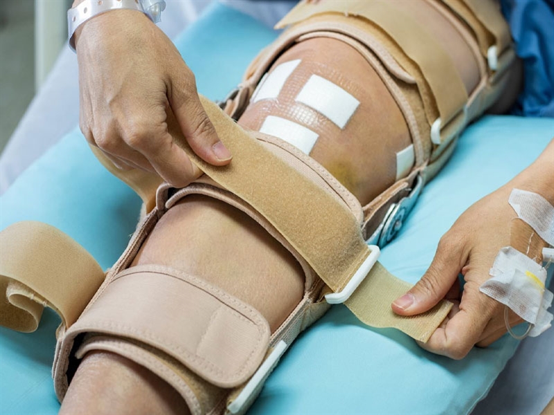 آیا زانوبندها واقعاً مؤثرند؟ نگاهی به مزایا و معایب