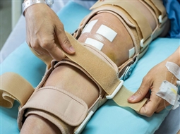 آیا زانوبندها واقعاً مؤثرند؟ نگاهی به مزایا و معایب