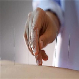 دکتر طب سوزنی؛ تسکین درد در کلینیک طب سوزنی  